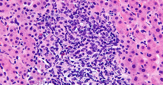 Read the article here.