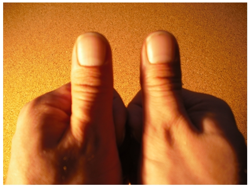 thumbs-800x600